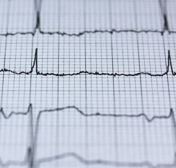 apex rise pulse model