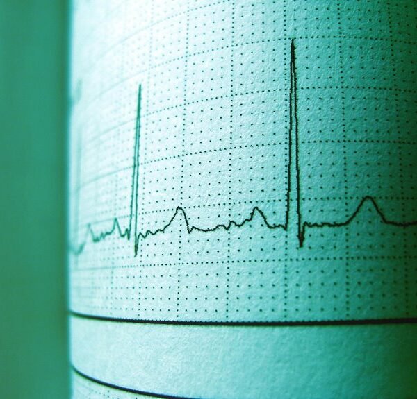 nova pulse opportunity track 914842500